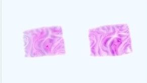 Paraffin Tissue Section - Human Adult Normal: Heart: Auricula (left)