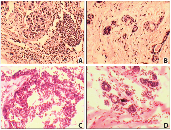 Matched Pair - Paraffin Tissue Section - Human Primary Tumor and Normal (PP): Colon
