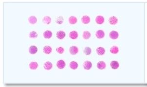 Breast Tumor Tissue Array - Duplicated 70 cases covering all the common types of breast cancer and 5 cases of normal and